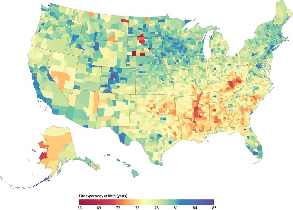a map of the US showing that life expectancy is higher in coastal areas, most of the Northeast, Midwest, and Western states. It's lower in Southern states, some counties in the West, and much of Alaska