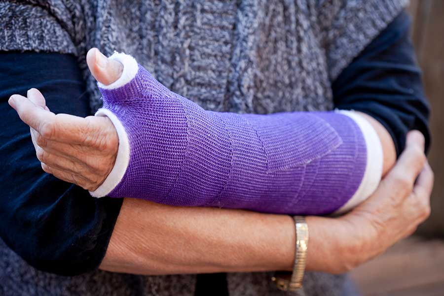 A person holding their arm in a cast.